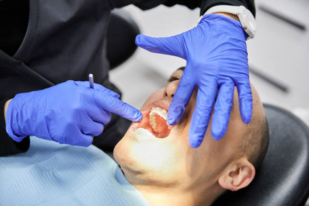 Best Emergency Dentist for Lost Fillings or Crowns in Princeton, WI
